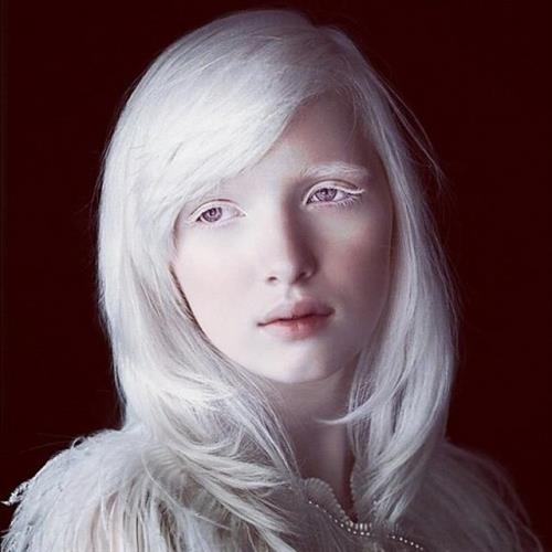 Beautiful albinos model