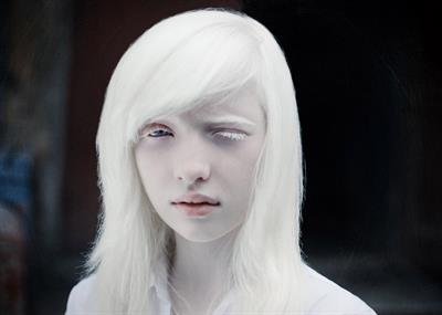 Beautiful albinos model