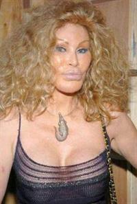 Jocelyn Wildenstein