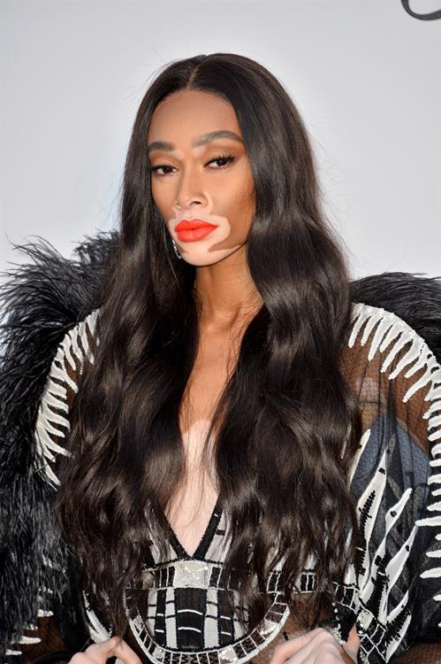 Winnie Harlow