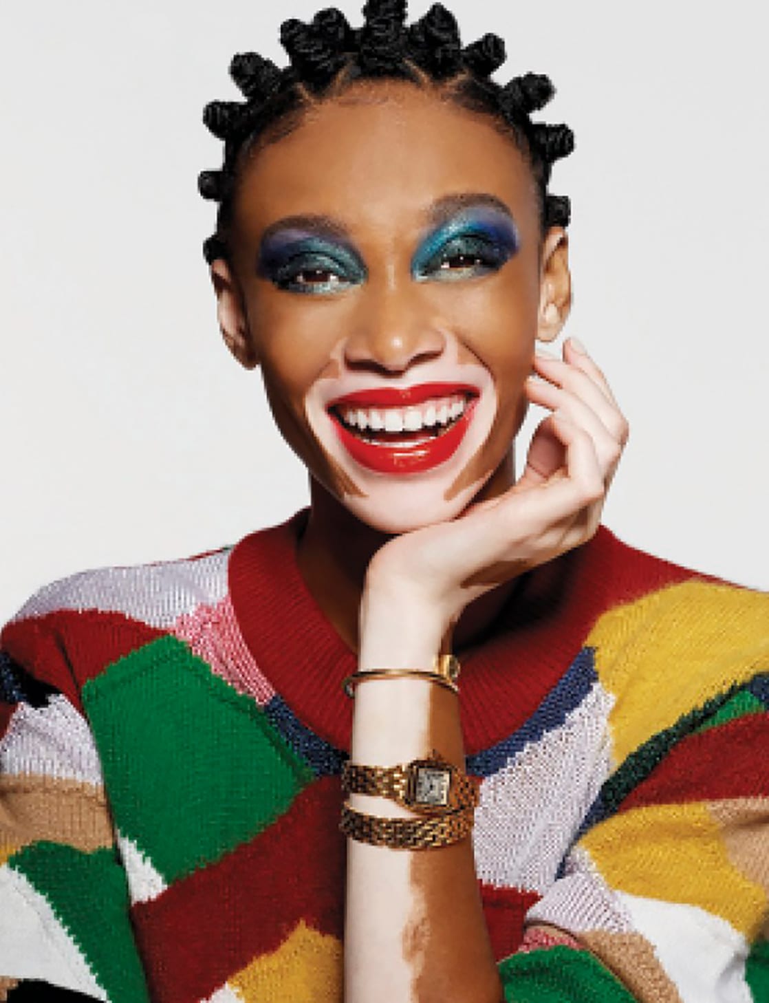 Winnie Harlow Pictures