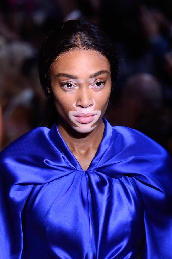 Winnie Harlow