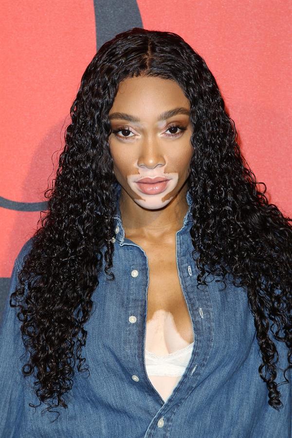 Winnie Harlow