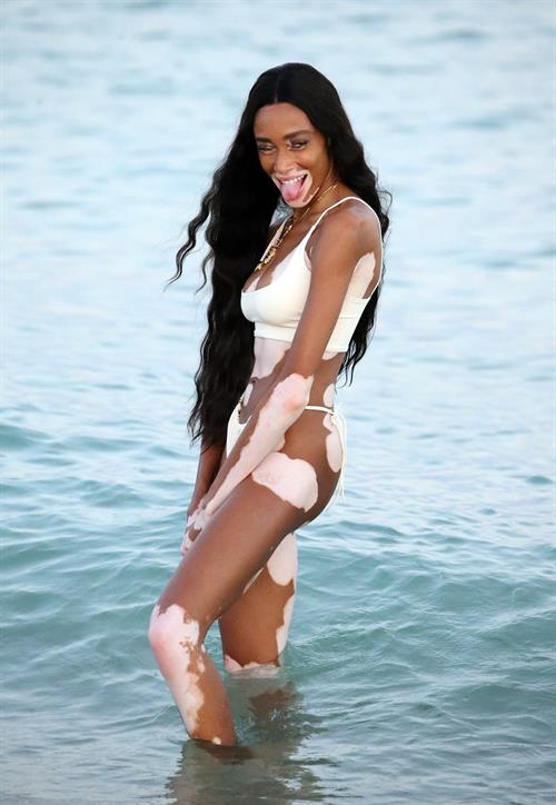 Winnie Harlow
